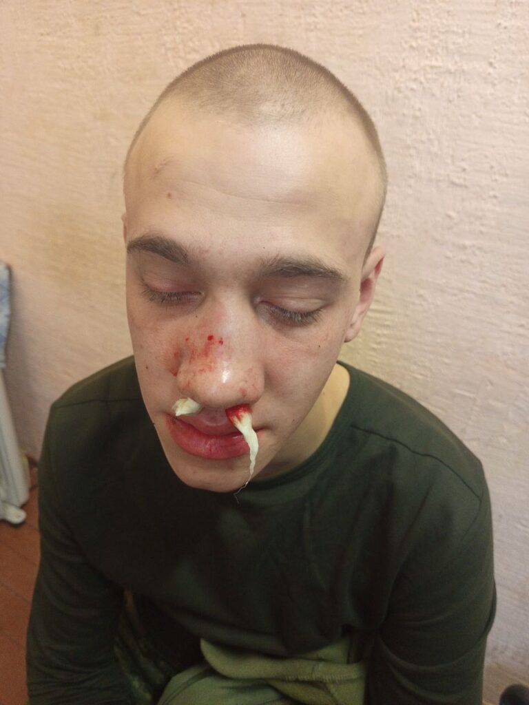 whatsapp-image-2025-09-09-at-13.17.27-768x1024 "Дружба народов" не удалась? Инцидент на учениях "Запад-2025".